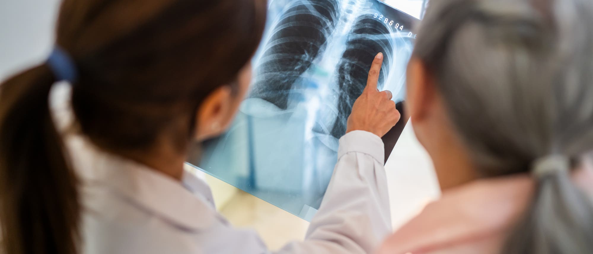 Eine Ärztin zeigt einer älteren Patientin ein Röntgenbild der Lunge. Die Ärztin deutet mit dem Finger auf eine bestimmte Stelle auf dem Bild, während die Patientin aufmerksam zusieht. Die Szene spielt sich in einer medizinischen Umgebung ab.