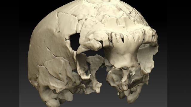 3-D-Rekonstruktion des Schädels