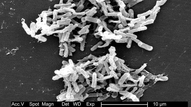 Elektronenmikroskopische Aufname von Clostridium difficilie