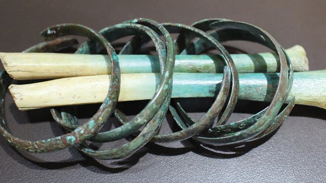 Amputierter Unterarmknochen mit Armschmuck