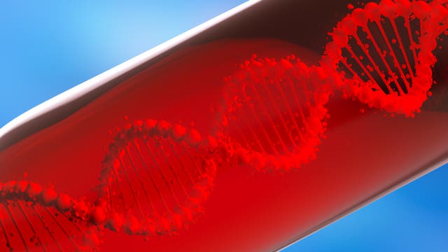 Das Blut von Menschen, die an Krebs erkrankt sind, enthält auch Tumor-DNA